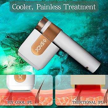 Amazon.com: JOVS Laser Hair Removal for Women and Men, Venus Pro